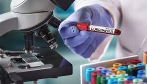 ثبت ۶ مورد ابتلای جدید به ویروس کرونا در استان ایلام ثبت ۶ مورد ابتلای جدید به ویروس کرونا در استان ایلام